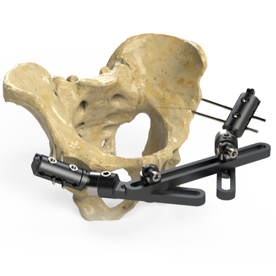 Fixateur externe axial dynamique (pelvien)