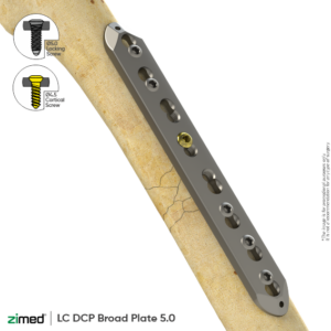 Locking LC DCP Broad Plate (4.5 Mm)