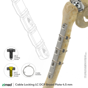 Cable Locking LC DCP Broad Plate (4.5 Mm)
