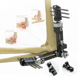 Extremity Elbow Fixator