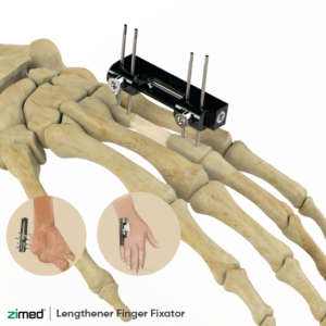 Lengthener Finger Fixator