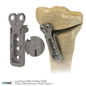 Locking Adjustable High Tibia Osteotomy Plate Type I