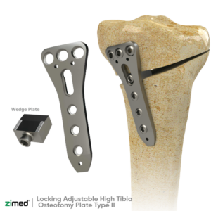 Locking Adjustable High Tibia Osteotomy Plate Type II
