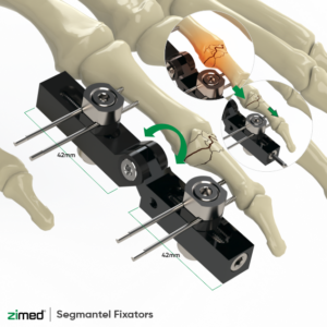 Finger Fixator (Joint)