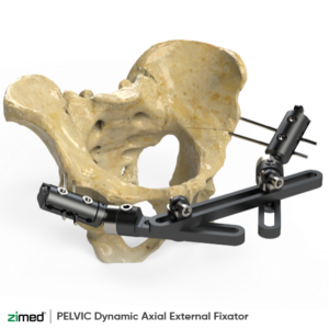 Dynamic Axial External Fixator (Pelvic)