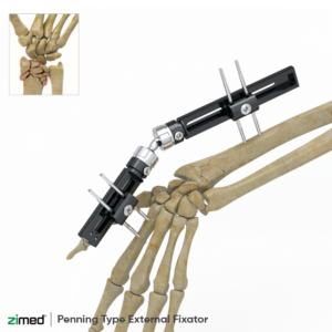 Penning Type External Fixator